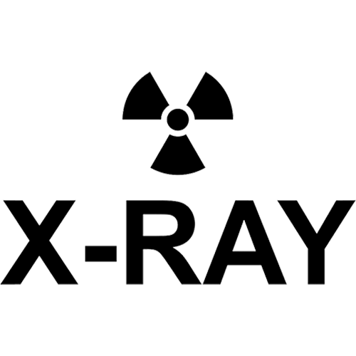 Ex-Ray